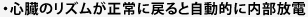 心臓のリズムが正常に戻ると自動的に内部放電